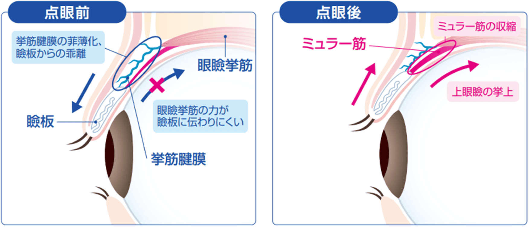 オキシメタゾリンの作用機序