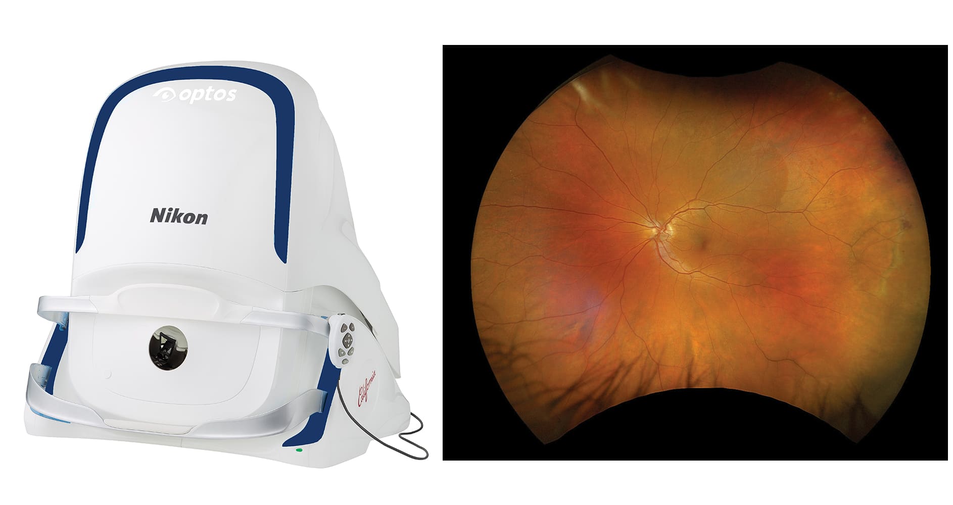 The Cataract Refractive Suite